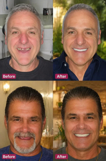 🌎Ends Today: 80% OFF!⏰KLENIMORE™ Custom-Fit Smile Support Kit — Strong Suction Feel & Natural-Looking Fit