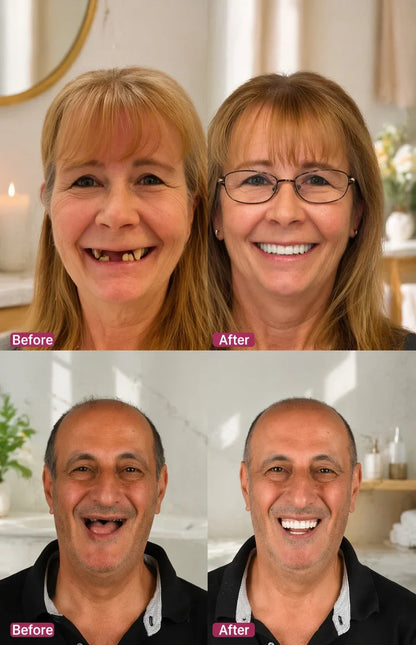 🌎Ends Today: 80% OFF!⏰KLENIMORE™ Custom-Fit Smile Support Kit — Strong Suction Feel & Natural-Looking Fit